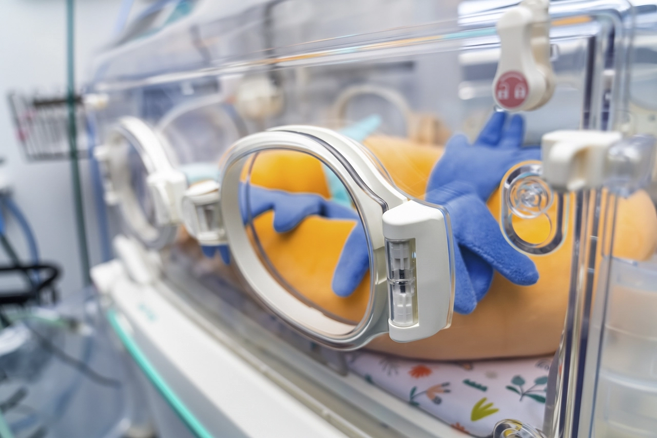 Incubadora, equipo empleado en la neonatología cuando hay un parto prematuro. Incubadora, equipo empleado en la neonatología cuando hay un parto prematuro.